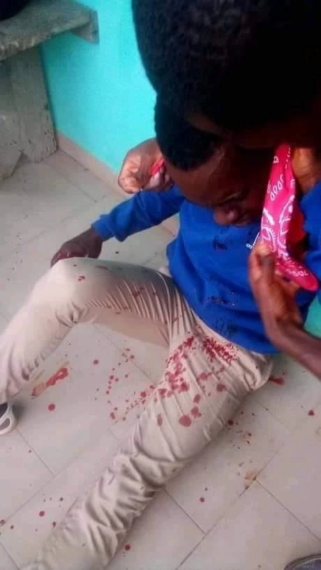 Des agressions à la machette entre élèves ont fait plusieurs blessés à Agboville