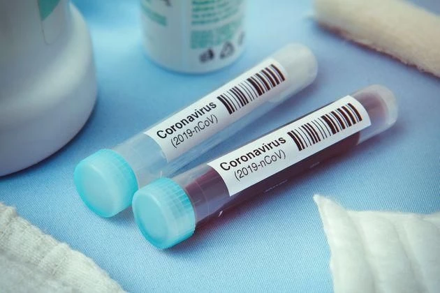  Des singes vaccinés ou infectés par le nouveau coronavirus ont développé des anticorps leur permettant d’être protégés