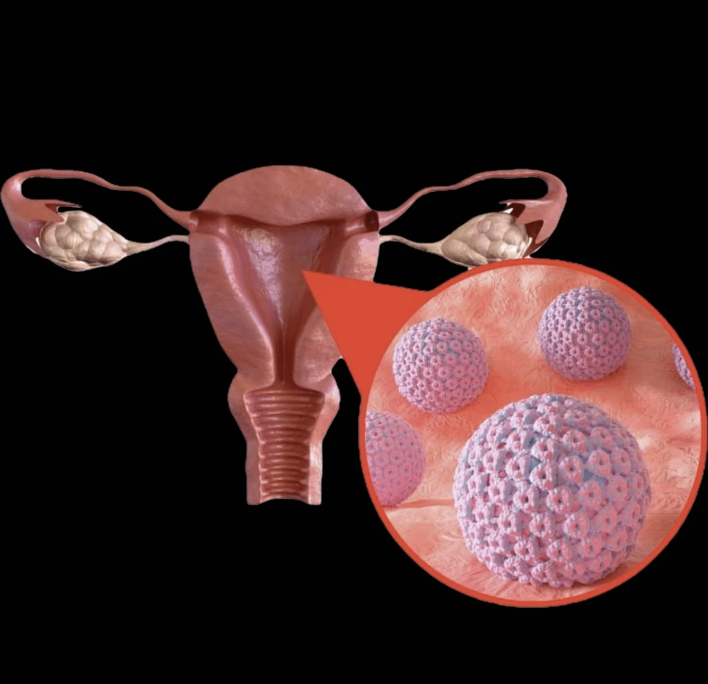 Guinée : Le combat « silencieux » de Dr Aïssatou Barry contre le cancer du col de l’utérus