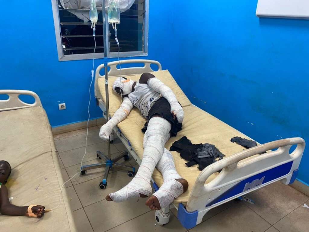 Centre des grands brûlés d’Abidjan : 1 lit pour 3 