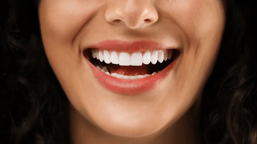 Esthétique dentaire en Turquie : pourquoi le naturel remplace le sourire ultra-blanc