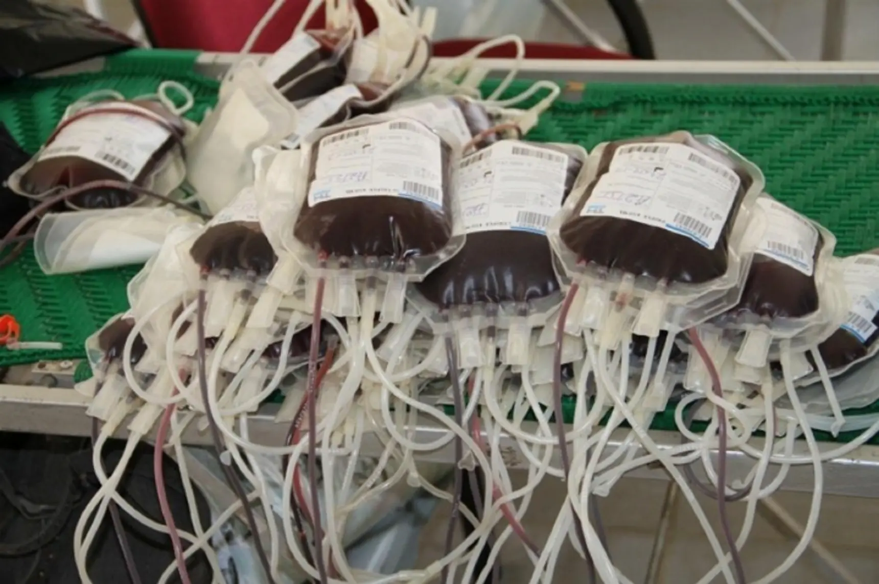 Blood Donation: Why Does a Bag Cost 3,000 FCFA When Donation is Free?