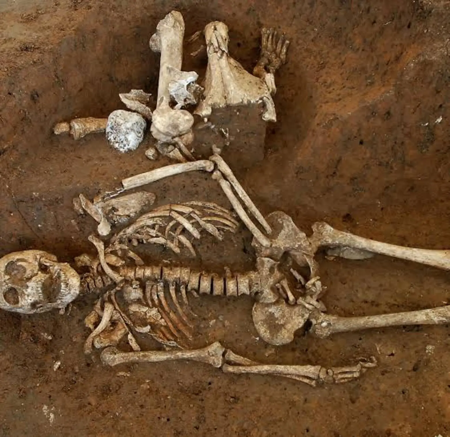 Cameroon: Human remains allegedly sold to traffickers to make “caillou” drug