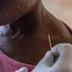 la-revue-de-l-actualite-internationale-1000-cas-de-mpox-en-rdc-n-djamena-inondee-presidentielle-au-cameroun