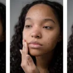 visage-impeccable-decouvrez-comment-eliminer-boutons-et-taches-de-maniere-naturelle