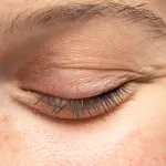 paupieres-qui-tressautent-comprendre-et-agir-efficacement
