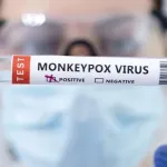 mpox-l-oms-valide-un-test-de-diagnostic-pour-freiner-l-epidemie-de-la-variole-du-singe