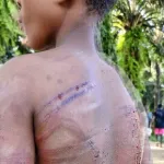 barbarie-a-montezo-un-enfant-mutile-par-son-oncle-pour-500-francs-nasseneba-toure-monte-au-creneau