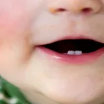 enfants-5-remedes-naturels-efficaces-pour-soulager-les-poussees-dentaires-de-votre-bebe