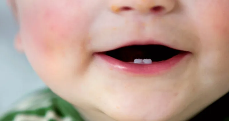 enfants-5-remedes-naturels-efficaces-pour-soulager-les-poussees-dentaires-de-votre-bebe