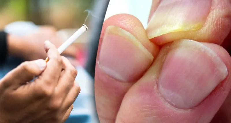 comment-eliminer-les-taches-de-nicotine-sur-les-mains-5-astuces-naturelles-et-efficaces