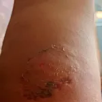 manfla-une-institutrice-battue-et-mordue-par-deux-femmes-deux-plaintes-croisees-a-gohitafla-et-zuenoula