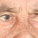 protegez-vos-yeux-apres-40-ans-7-conseils-essentiels-pour-preserver-votre-vue