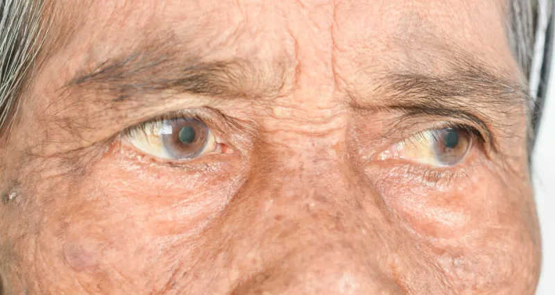 protegez-vos-yeux-apres-40-ans-7-conseils-essentiels-pour-preserver-votre-vue