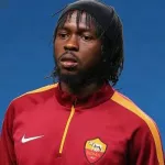perruque-ou-calvitie-gervinho-s-explique-sur-ses-cheveux