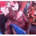 agression-sur-des-manifestants-de-l-opposition-a-yopougon-le-camp-ouattara-accuse