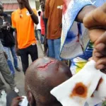 toumodi-surpris-le-voleur-ouvre-le-crane-de-sa-victime