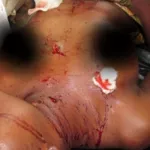 crime-dans-une-residence-une-dame-tuee-a-coups-de-machette-son-oreille-sectionnee