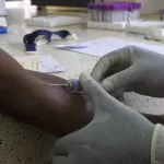 cancers-en-cote-d-ivoire-70-des-malades-meurent-5-ans-apres-la-pose-du-diagnostic