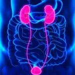 calcul-renal-attention-a-la-viande-de-brousse-au-lait-au-manque-d-eau