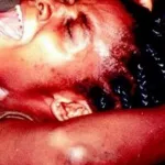 duekoue-il-decapite-une-femme-et-viole-son-cadavre