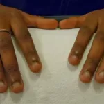 beaute-5-astuces-pour-arreter-de-se-ronger-les-ongles