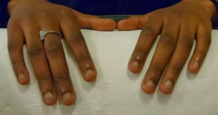 beaute-5-astuces-pour-arreter-de-se-ronger-les-ongles