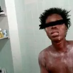 affaire-femme-defiguree-a-l-acide-a-memni-alepe-le-mari-eprouve-financierement-demande-de-l-aide