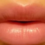 avoir-des-levres-roses