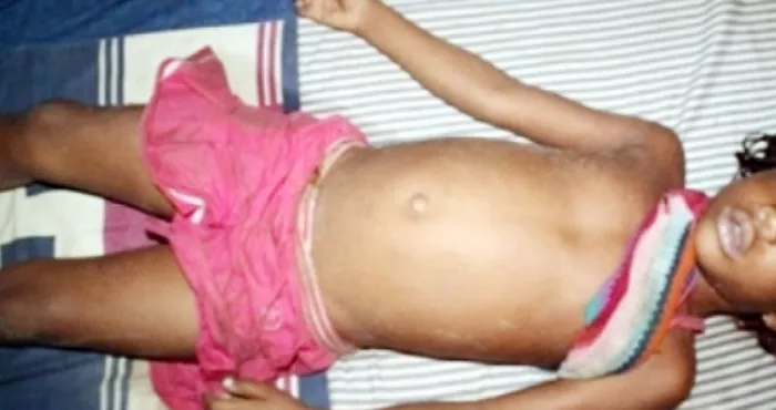 une-fillette-de-2-ans-en-soins-intensifs-apres-son-viol-par-un-homme-de-40-ans