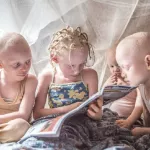 journee-mondiale-de-la-sensibilisation-a-l-albinisme-les-albinos-de-cote-d-ivoire-plaident-pour-leur-insertion-professionnelle