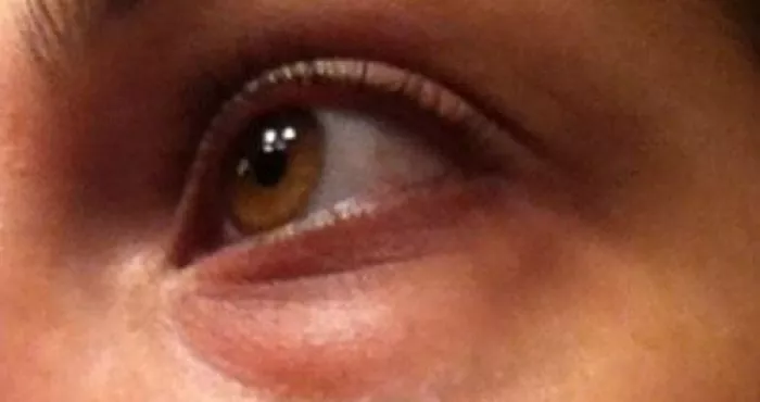 cinq-astuces-naturelles-contre-les-cernes