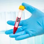 vaccin-contre-le-sida-des-chercheurs-font-des-progres