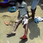 yopougon-affrontements-meurtriers-entre-microbes-plusieurs-victimes-dont-des-morts-les-mi-24-deployes-dans-la-zone