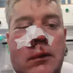 irlande-tabasse-par-3-joueurs-et-un-supporter-l-arbitre-daniel-sweeney-a-eu-la-machoire-fracturee