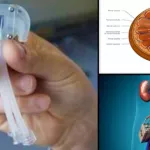 traitement-de-l-insuffisance-renale-des-chercheurs-americains-mettent-au-point-un-rein-artificiel