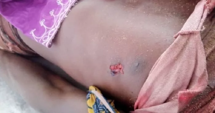 abobo-belleville-mort-tragique-d-un-jeune-tue-par-des-microbes-le-temoignage-pathetique-de-l-oncle-de-konate-souleymane-une-plainte-deposee