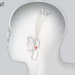 technologie-une-entreprise-americaine-met-en-place-un-ordinateur-pilote-a-partir-du-cerveau-humain