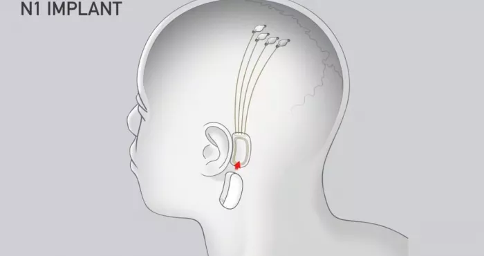 technologie-une-entreprise-americaine-met-en-place-un-ordinateur-pilote-a-partir-du-cerveau-humain