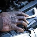 abobo-un-mecanicien-grievement-blesse-par-balle-alors-qu-il-volait-la-batterie-d-une-voiture