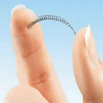 france-une-chirurgienne-perd-son-uterus-et-ses-trompes-a-cause-d-un-implant-contraceptif