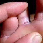 en-finir-avec-les-pieds-d-athlete