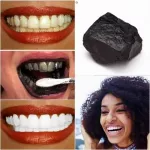 traitement-efficace-pour-enlever-le-tartre-dentaire-a-base-du-charbon