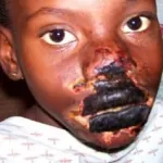 abengourou-l-accusant-d-avoir-mange-chez-le-voisin-un-pere-brule-la-bouche-de-son-fils-avec-une-pierre-chauffee