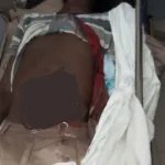 anyama-un-eleve-de-3eme-eventre-par-son-aine-de-terminal-ses-intestins-retrouve-dehors