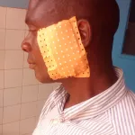 buyo-un-agent-de-la-mairie-battu-a-sang-par-des-jeunes-gens