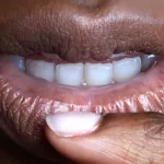 levres-seches-en-temps-d-harmattan-voici-des-methodes-naturelles-simples-pour-soigner-des-levres-gercees