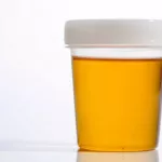 comment-faire-son-test-de-grossesse-a-la-marocaine-avec-une-aiguille