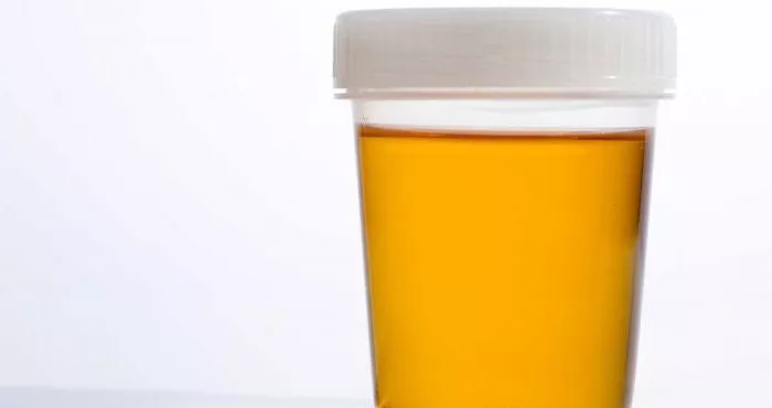 comment-faire-son-test-de-grossesse-a-la-marocaine-avec-une-aiguille