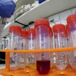 coronavirus-l-oms-decrete-une-urgence-de-sante-publique-de-portee-internationale